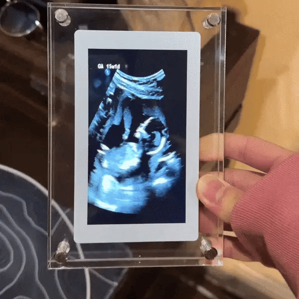 Renoura ™ Memory Frame