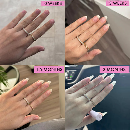 Renoura™ Nail Growth Serum