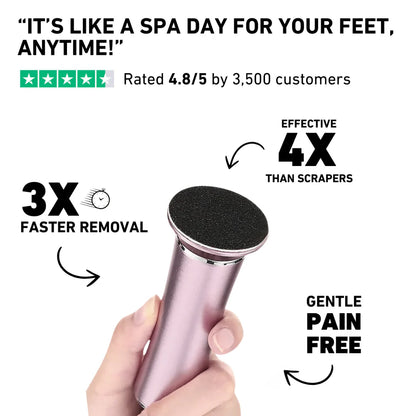 Renoura ™ Electric Callus Remover